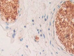 Invitrogen HBD Polyclonal Antibody 20 &mu;L; Unconjugated:Antibodies, Polyclonal