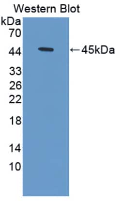 Invitrogen HBD Polyclonal Antibody 20 &mu;L; Unconjugated:Antibodies, Polyclonal