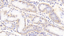 Invitrogen Perlecan Polyclonal Antibody 20 &mu;L; Unconjugated:Antibodies,