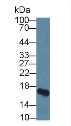 Invitrogen HBEGF Polyclonal Antibody:Antibodies:Primary Antibodies