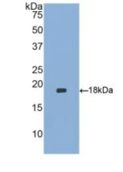 Invitrogen HBEGF Polyclonal Antibody 200 &mu;L; Unconjugated:Antibodies,