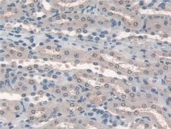Invitrogen HPS4 Polyclonal Antibody 20 &mu;L; Unconjugated:Antibodies,