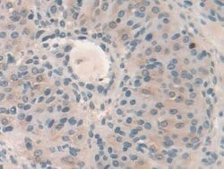 Invitrogen HPS4 Polyclonal Antibody 20 &mu;L; Unconjugated:Antibodies,