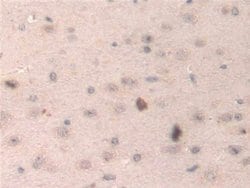 Invitrogen HPS4 Polyclonal Antibody 20 &mu;L; Unconjugated:Antibodies,