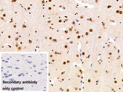 Invitrogen hnRNP A2B1 Polyclonal Antibody 200 &mu;L; Unconjugated:Antibodies,