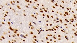 Invitrogen HMGB1 Polyclonal Antibody 200 &mu;L; Unconjugated:Antikörper
