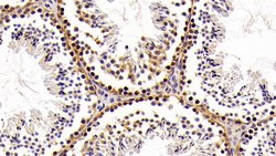 Invitrogen HMGB1 Polyclonal Antibody 200 &mu;L; Unconjugated:Antikörper