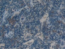 Invitrogen HMGB1 Polyclonal Antibody:Antibodies:Primary Antibodies