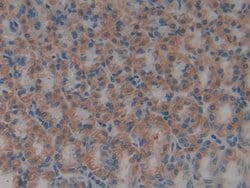 Invitrogen HMGB1 Polyclonal Antibody:Antibodies:Primary Antibodies
