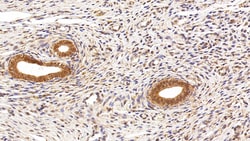 Invitrogen HMGB1 Polyclonal Antibody:Antibodies:Primary Antibodies