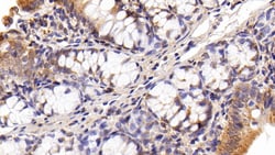Invitrogen HMGB1 Polyclonal Antibody:Antibodies:Primary Antibodies