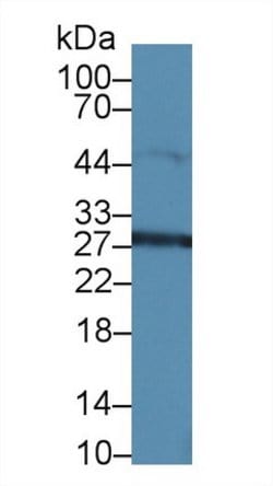 Invitrogen HMGB1 Polyclonal Antibody:Antibodies:Primary Antibodies