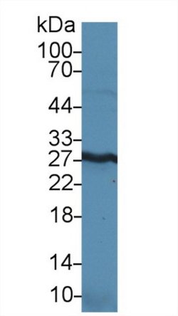 Invitrogen HMGB1 Polyclonal Antibody:Antibodies:Primary Antibodies