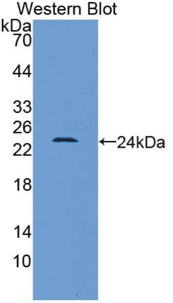 Invitrogen HMGB1 Polyclonal Antibody:Antibodies:Primary Antibodies