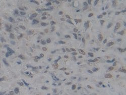 Invitrogen HMGB1 Polyclonal Antibody:Antibodies:Primary Antibodies