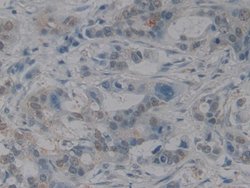 Invitrogen HMGB1 Polyclonal Antibody:Antibodies:Primary Antibodies