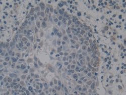 Invitrogen HMGB1 Polyclonal Antibody:Antibodies:Primary Antibodies