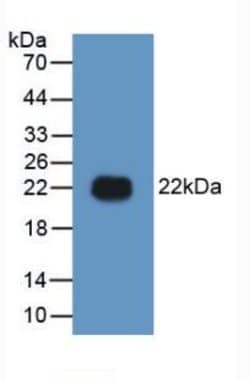 Invitrogen HMGB1 Polyclonal Antibody:Antibodies:Primary Antibodies