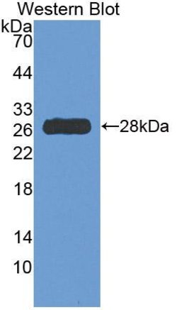 Invitrogen HDC Polyclonal Antibody:Antibodies:Primary Antibodies