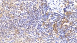 Invitrogen HLA-DRA Polyclonal Antibody 20 &mu;L; Unconjugated:Antibodies,