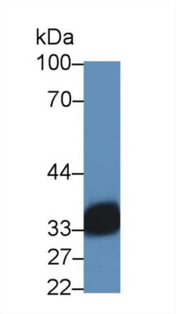 Invitrogen HLA-DRA Polyclonal Antibody 20 &mu;L; Unconjugated:Antibodies,