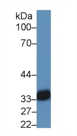Invitrogen HLA-DRA Polyclonal Antibody 20 &mu;L; Unconjugated:Antibodies,