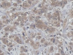 Invitrogen HCFC1 Polyclonal Antibody:Antibodies:Primary Antibodies