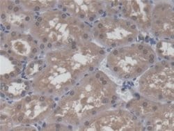 Invitrogen HCFC1 Polyclonal Antibody:Antibodies:Primary Antibodies