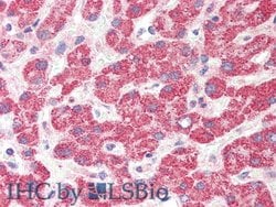 Invitrogen HAO1 Polyclonal Antibody:Antibodies:Primary Antibodies
