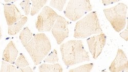 Invitrogen INHBE Polyclonal Antibody 20 &mu;L; Unconjugated:Antibodies,