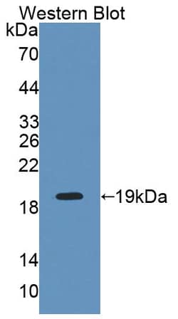 Invitrogen INPP4A Polyclonal Antibody:Antibodies:Primary Antibodies