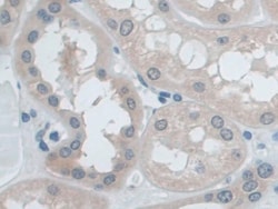 Invitrogen IDE Polyclonal Antibody:Antibodies:Primary Antibodies
