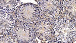 Invitrogen IDE Polyclonal Antibody:Antibodies:Primary Antibodies