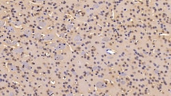 Invitrogen IDE Polyclonal Antibody:Antibodies:Primary Antibodies