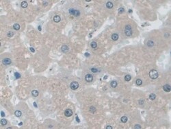 Invitrogen IDE Polyclonal Antibody:Antibodies:Primary Antibodies