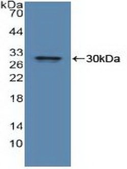 Invitrogen IDE Polyclonal Antibody:Antibodies:Primary Antibodies