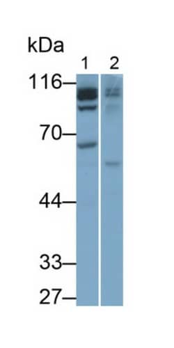 Invitrogen IDE Polyclonal Antibody:Antibodies:Primary Antibodies