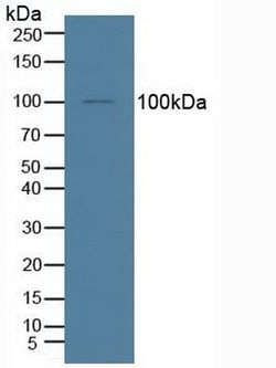 Invitrogen IDE Polyclonal Antibody:Antibodies:Primary Antibodies