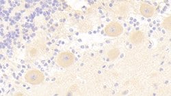 Invitrogen IRS2 Polyclonal Antibody:Antibodies:Primary Antibodies