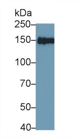 Invitrogen IRS2 Polyclonal Antibody:Antibodies:Primary Antibodies