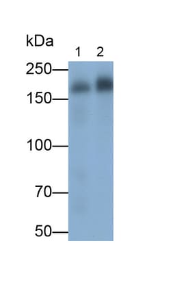 Invitrogen IRS2 Polyclonal Antibody:Antibodies:Primary Antibodies