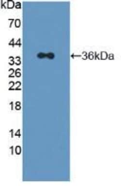Invitrogen IRS2 Polyclonal Antibody:Antibodies:Primary Antibodies