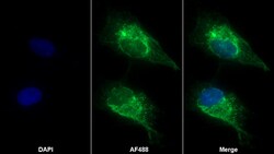 Invitrogen CD51 Polyclonal Antibody 20 &mu;L; Unconjugated:Antibodies,