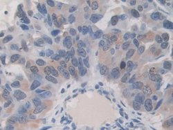 Invitrogen ITIH1 Polyclonal Antibody 200 &mu;L; Unconjugated:Antibodies,