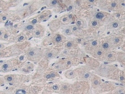 Invitrogen ITIH1 Polyclonal Antibody:Antibodies:Primary Antibodies