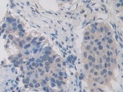 Invitrogen ITIH1 Polyclonal Antibody 200 &mu;L; Unconjugated:Antibodies,