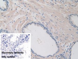 Invitrogen ITIH1 Polyclonal Antibody:Antibodies:Primary Antibodies