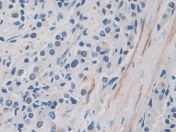 Invitrogen ITIH1 Polyclonal Antibody 200 &mu;L; Unconjugated:Antibodies,