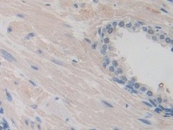Invitrogen ITIH1 Polyclonal Antibody 200 &mu;L; Unconjugated:Antibodies,