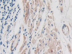 Invitrogen ITIH1 Polyclonal Antibody 200 &mu;L; Unconjugated:Antibodies,